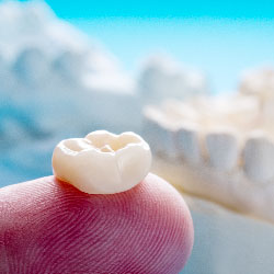 Single teeth crown and bridge equipment model express fix restoration