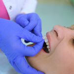 Dentist puts dental veneers patient and correction of teeth