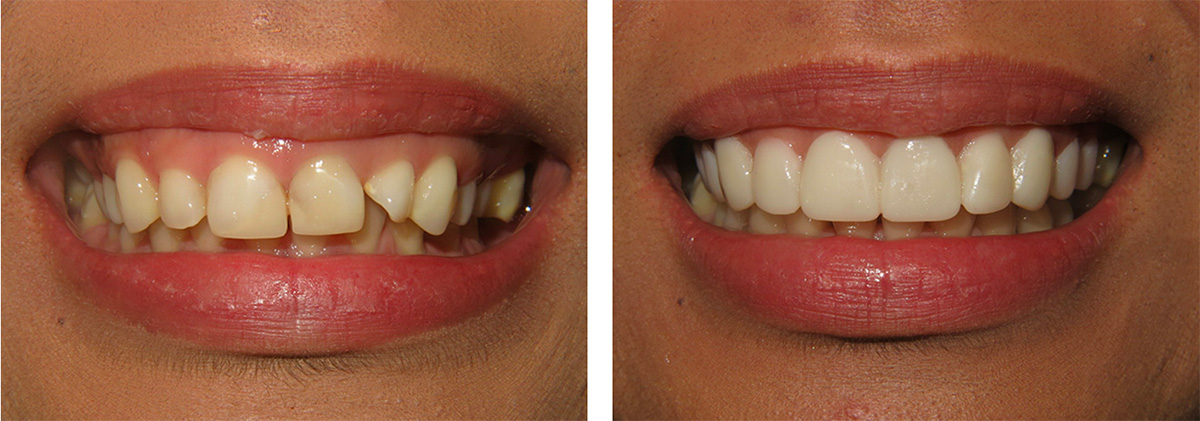 Trial Smile Before And After Photos Portland