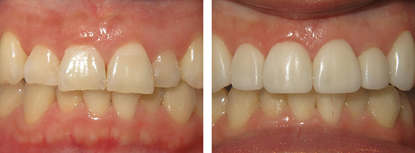 Before and After photos